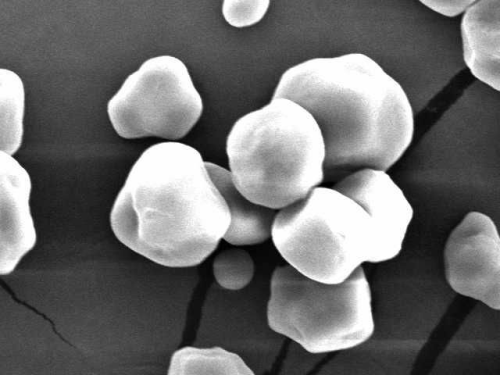 Figure 4b: Electron micrograph of corn starch particles.