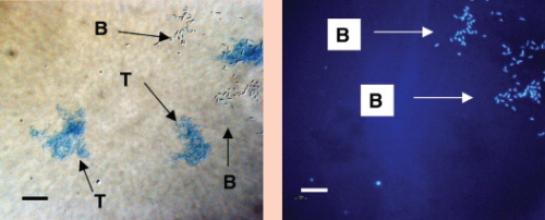 Microscope images of TEP and bacteria adhering to a glass surface immersed in coastal sea water after 18 hours. T = TEP; B = Bacteria; Scale bar - 10 microns.