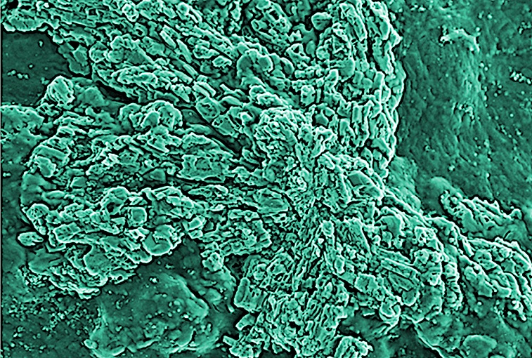 Biofouling under the microscope.