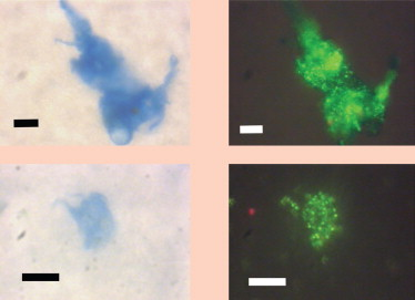 Freshwater lake Kinneret
Upper and lower left: TEP particles when stained with Alcian Blue dye are blue-coloured under regular illumination.

Upper and lower right: Same fields but viewed under epifluorescent illumination, bacteria appear as bright green spots or rods. The greenish background may be due to nucleic acids associated with 

TEP. Scale bars – 10 microns.
