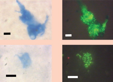 Freshwater lake Kinneret
Upper and lower left: TEP particles when stained with Alcian Blue dye are blue-coloured under regular illumination.

Upper and lower right: Same fields but viewed under epifluorescent illumination, bacteria appear as bright green spots or rods. The greenish background may be due to nucleic acids associated with 

TEP. Scale bars – 10 microns.