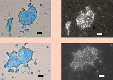 Recycled secondary treated wastewater

Upper and lower left: TEP are blue-coloured under regular illumination.

Upper and lower right: Same fields but viewed under epifluorescent illumination and photographed in black and white. Here the bacteria appear as white spots or rods. Scale bars – 10 microns.