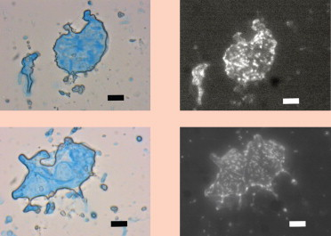 Recycled secondary treated wastewater

Upper and lower left: TEP are blue-coloured under regular illumination.

Upper and lower right: Same fields but viewed under epifluorescent illumination and photographed in black and white. Here the bacteria appear as white spots or rods. Scale bars – 10 microns.