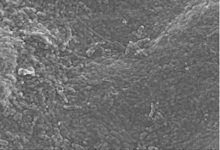 Bacterial colony seen by microscopy (3 micrometer range).