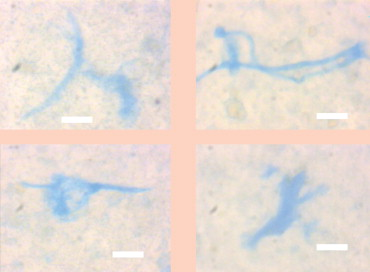 Coastal Mediterranean seawater 
TEP are blue-coloured under regular illumination. In these samples only a few bacteria were observed on the TEP. Scale bars – 10 microns.