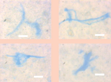 Coastal Mediterranean seawater 
TEP are blue-coloured under regular illumination. In these samples only a few bacteria were observed on the TEP. Scale bars – 10 microns.