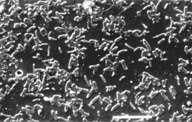 Figure 4. Bio-fouling on an SEM slide post dechlorination