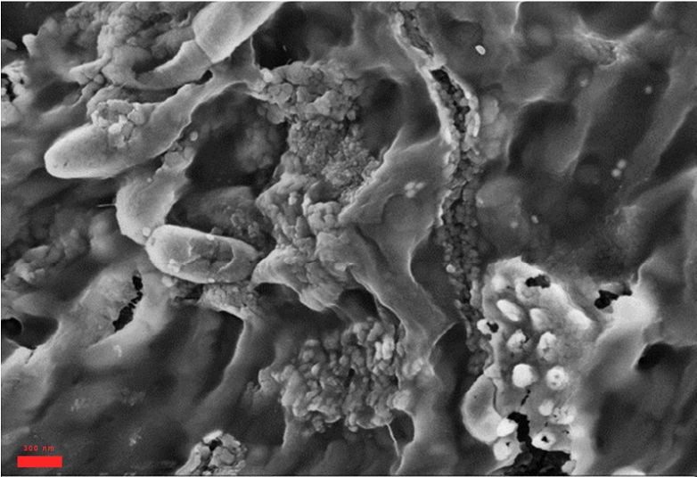 Bacterial colony mixed with crystal scale by microscopy (300 nm range).