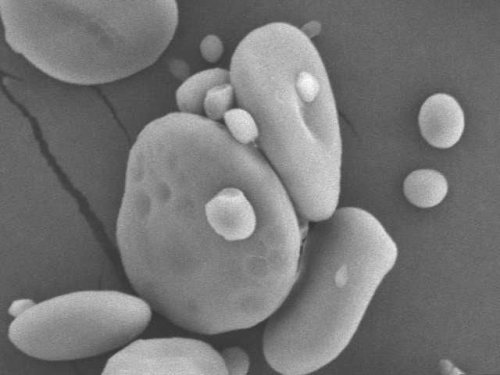 Figure 4a: Electron micrographs of starch grains - wheat. Note the bi-modal nature of the wheat starch particles (see Box - Wheat starch).