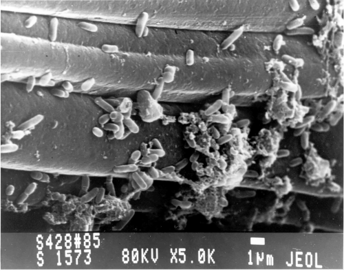 Bacteria on the fibres of Zorflex